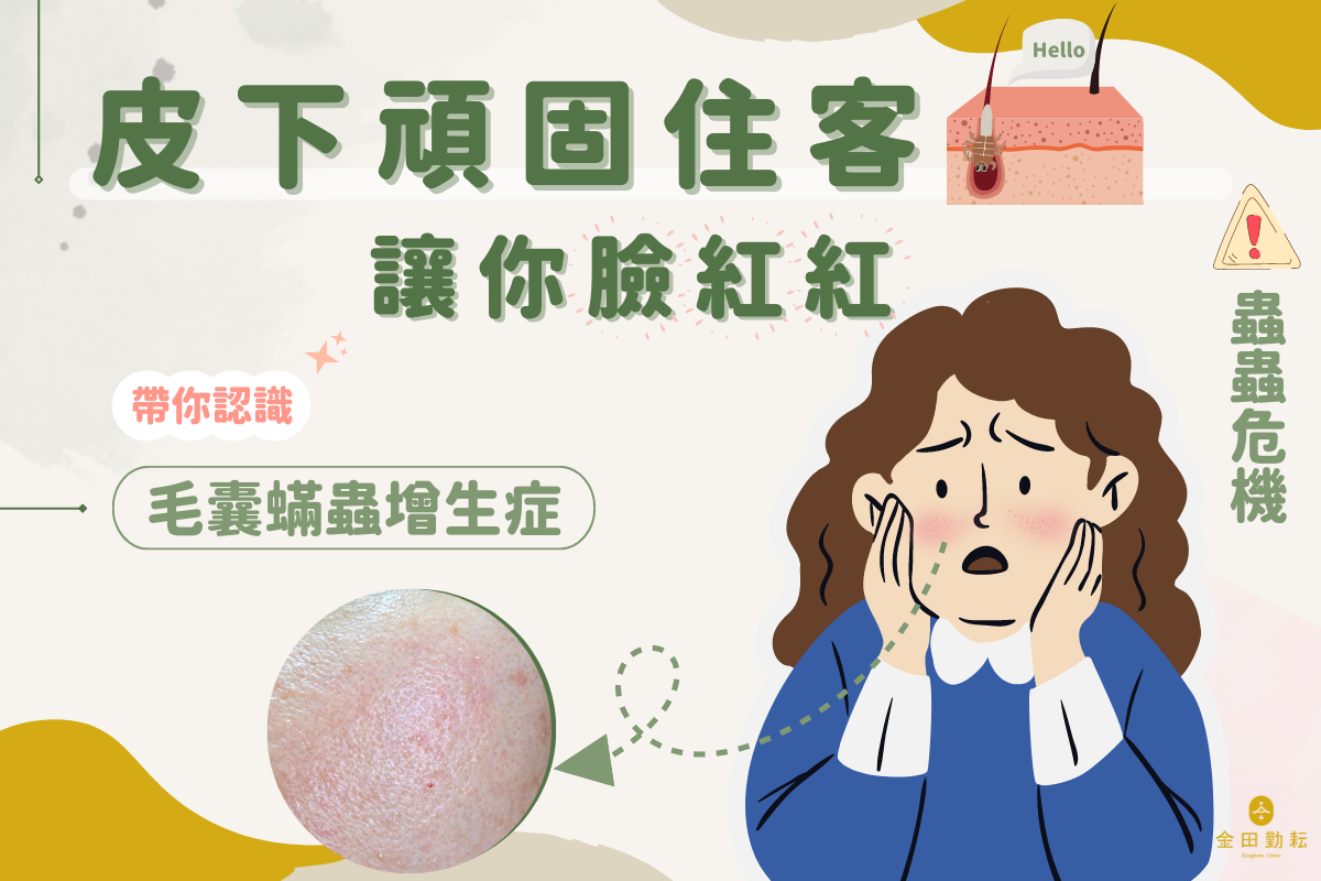 粉刺青春痘